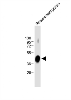 ADAMTS4 Mouse Monoclonal Antibody