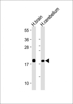 VILIP1 Mouse Monoclonal Antibody