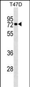 MX1 Mouse Monoclonal Antibody