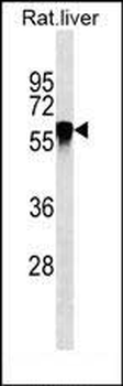 SERPINC1 Mouse Monoclonal Antibody