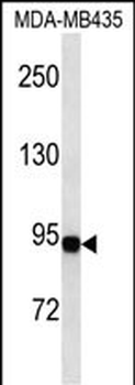Gelsolin Mouse Monoclonal Antibody