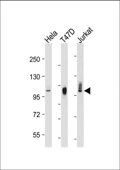 LAMP2 Mouse Monoclonal Antibody