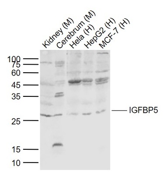 IGFBP5 antibody