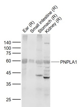 PNPLA1 antibody