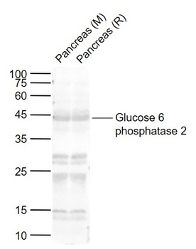 Glucose 6 Phosphatase 2 antibody