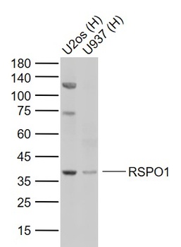 RSPO1 Rabbit Polyclonal Antibody