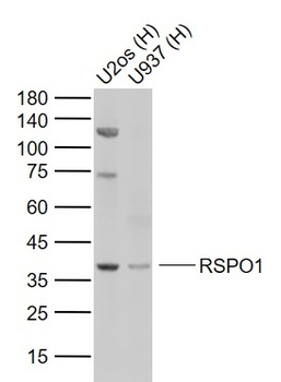 RSPO1 antibody