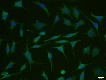 Phospho-IRS-2 (Ser731) Rabbit Polyclonal Antibody
