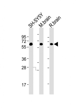 DPYSL5 Mouse Monoclonal Antibody