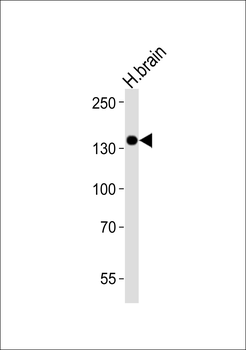 TrkC Mouse Monoclonal Antibody