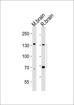 TrkC Mouse Monoclonal Antibody