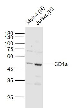 CD1a Rabbit Polyclonal Antibody