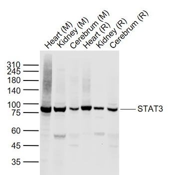 STAT3 Rabbit Polyclonal Antibody