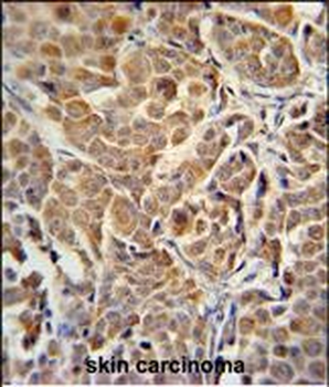ALDH3A2 Mouse Monoclonal Antibody