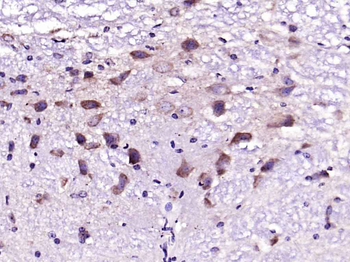NMDAR2B Rabbit Polyclonal Antibody