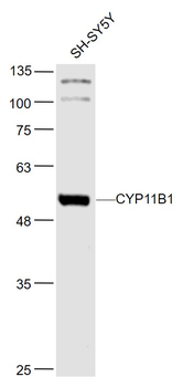 CYP11B1 Rabbit Polyclonal Antibody
