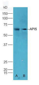 API5 Rabbit Polyclonal Antibody