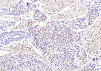 CD73 Mouse Monoclonal Antibody
