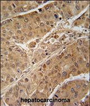 RPS6KB2 Mouse Monoclonal Antibody