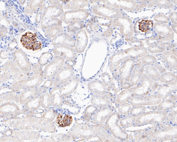 NPHS2 Recombinant Rabbit Monoclonal Antibody