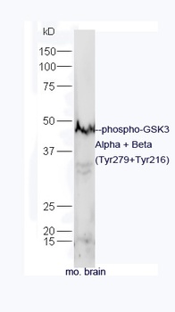GSK3 Alpha + Beta (phospho-Tyr279+Tyr216) antibody [Out of stock] [Out of stock]