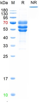 Human Fibrinogen (from plasma)