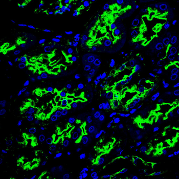 Immunohistochemical analysis of paraffin-embedded human Kidney tissues using ACE2 antibody with DAB staining. Pre-treat the sections with heat-mediated antigen retrieval using sodium citrate buffer (pH 6.0) for 2 minutes. Wash the sections with ddH2O and PBS. Block the tissue with 10% non-immune goat serum at room temperature for 30 minutes. Incubate the tissue with the primary antibody diluted at a ratio of 1:150 at 4C overnight. At room temperature, dilute the secondary antibody, Goat Anti-Mouse IgG (H&amp;L)-HRP, at a ratio of 1:150 and incubate for one hour. Tyramine labeled with 488 (Green) was used as chromogenic agent, and DAPI (Blue) was used for double dyeing, and the anti-fluorescence attenuation tablets were sealed.