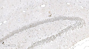 Anti-Aryl hydrocarbon Receptor/AHR Antibody