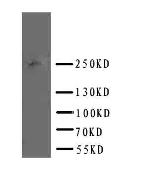 ABCA4 Antibody