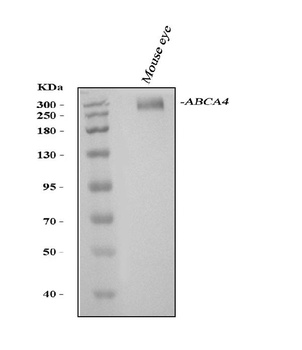Anti-ABCA4 Antibody