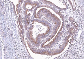Anti-ALDH3A1 Antibody