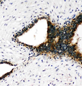 Anti-Annexin VII/ANXA7 Antibody