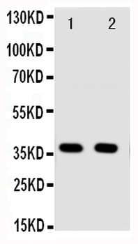 Anti-Annexin A10/ANXA10 Antibody