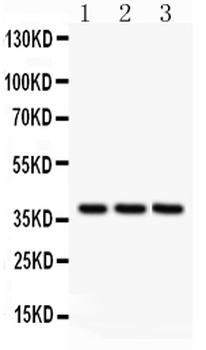Anti-Bonzo/CXCR6 Antibody