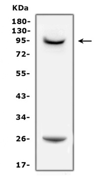 Anti-Prolactin Receptor/PRLR Antibody