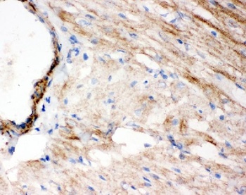 Anti-WISP1 Antibody
