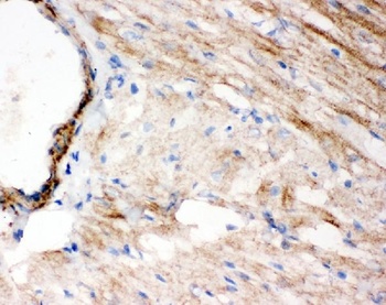 WISP1 Antibody