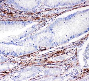 Anti-Collagen I/COL1A1 Antibody