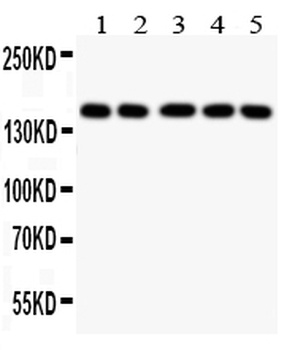 Collagen II/COL2A1 Antibody