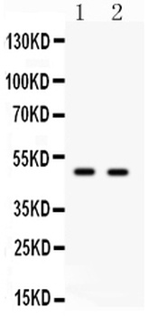Transcription factor E2F3 E2F3 Antibody