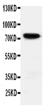 Anti-HIF3/HIF3A Antibody