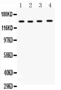 Anti-Matrix metalloproteinase-14 MMP14 Antibody