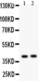 Protein NDRG2 NDRG2 Antibody