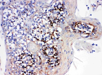 Anti-Cyclophilin B/PPIB Antibody