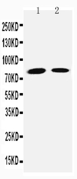 Transglutaminase 2/TGM2 Antibody