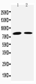Anti-Transglutaminase 2/TGM2 Antibody