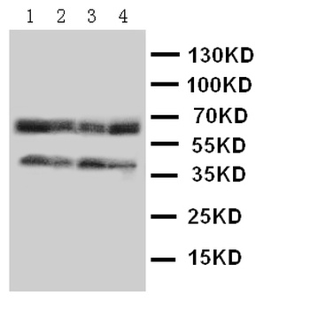 Anti-C-C chemokine receptor type 5 CCR5 Antibody