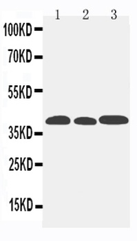 Anti-C-C chemokine receptor type 5 CCR5 Antibody