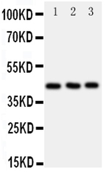 C-C chemokine receptor type 9 CCR9 Antibody