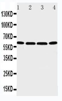 Anti-P2X6/P2RX6 Antibody